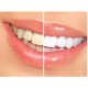 Aparat albire dinti Dental White